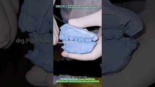 Kasus LUAR BIASA BIMAXILLARY PROTRUSION GIGI sudah MUNDUR  PART 1 OF 3 [upl. by Hume]