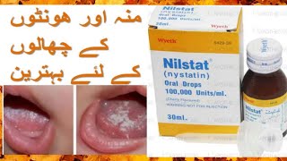 Nilstat  nystatin  oral drops  Uses and side effects in urdu and hindi [upl. by Steddman965]