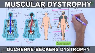 Muscular Dystrophy  Types and Mutations [upl. by Nomi]