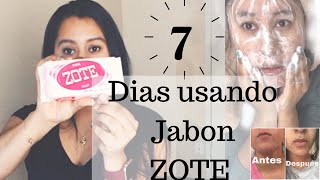 7 Dias Usando JABON ZOTE  JABON ZOTE para La Cara  BENEFICIOS del JABON ZOTE  jabon ZOTE JENNY [upl. by Nostaw38]