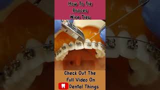 How To Tie Braces  Wire Tie Ligatures [upl. by Fisk296]