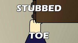 Stubbed Toe [upl. by Diao]