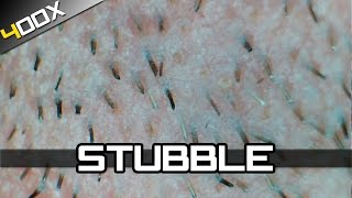 Magnified 400x  Stubble [upl. by Germin]