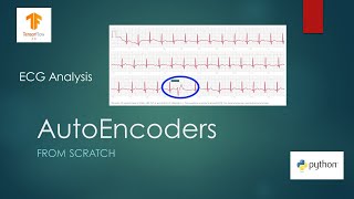 Anomaly Detection with AutoEncoders using Tensorflow [upl. by Atsyrk979]