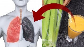 How to cleanse Smokers Lungs Naturally in one Day  DETOX YOUR LUNGS [upl. by Marion]