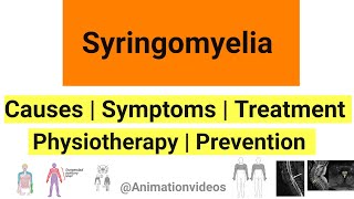 What is Syringomyelia  Pathophysiology  Symptoms  Physiotherapy Treatment [upl. by Mungam968]