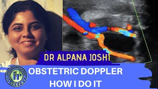 Obstetric Doppler  How I Do It  Dr Alpana Joshi  UMBILICAL ARTERY DOPPLER  MCA PI [upl. by Jenni]