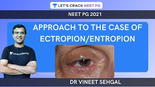 Approach to the case of EctropionEntropion  NEETPG 2021  Vineet Sehgal [upl. by Haugen]