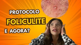 ✅Protocolo para foliculite [upl. by Eniwtna193]