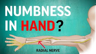 Relieve Hand Numbness  Radial Nerve Flossing for Nerve Entrapment [upl. by Ettenej571]