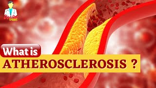 What is Atherosclerosis [upl. by Tarkany]