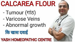 Calcarea Flour explained  Dose and symptoms  Brain tumour  varicose veins [upl. by Aninad451]