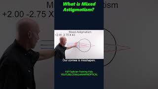 What is Mixed Astigmatism [upl. by Vidda455]