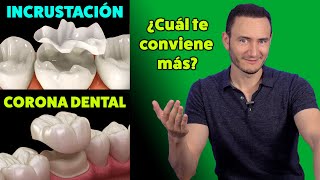 Incrustación vs Corona Dental ¿Cuál te conviene más  Cuando está indicada [upl. by My]