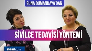 Sivilce nasıl geçer Suna Dumankayanın önerisi  Sağlık  Nasilcom [upl. by Joachima]