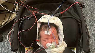 Find out why your newborn failed hospital hearing test it may be the test at fault oae vs abr test [upl. by Caesar827]