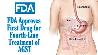 FDA Approves Qinlock ripretinib for FourthLine Treatment of AGST [upl. by Nomihs120]