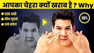 Why Doesnt Your Face Glowing  सावले चेहरे वाले जरूर देखे 2022 [upl. by Nivlak]