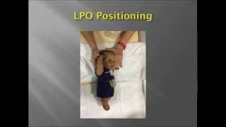 Pediatric Upper GI Fluoroscopy exam [upl. by Shelah]