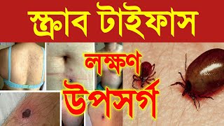 scrub typhus  scrub typhus symptoms  what is scrub typhus disease  symptoms of scrub typhus [upl. by Gwynne]