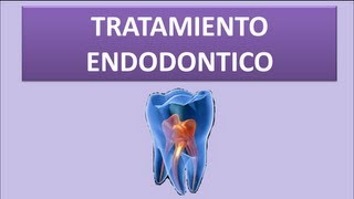 Tratamiento Endodóntico Materiales y Procedimiento [upl. by Landmeier]