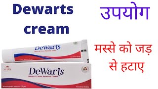 Dewarts cream  dewarts cream uses in hindi  wart ka ilaj in hindi  चेहरे के मस्से हटाने की दवा [upl. by Grunberg]