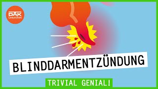 Blinddarmentzündung Wie sie entsteht und du sie erkennst  Trivial Genial  DAKGesundheit [upl. by Oicnedurp326]