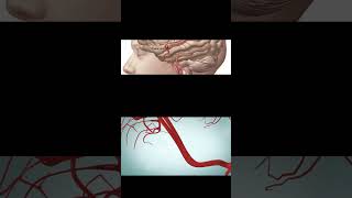 Brain Aneurysm Pathology  Etiology  Pathogenesis  Clinical manifestations  Diagnosis amp Treatment [upl. by Payson108]