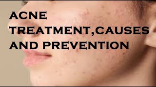 acne treatmentcauses and prevention [upl. by Ayatal501]