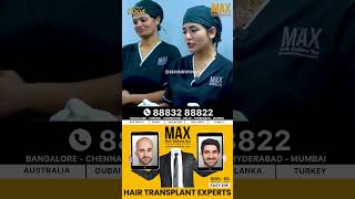 Want flawless hair like Ma ka pa Anand ➡Visit Max Hair Clinic hairclinic hairfallcontrol [upl. by Kiernan]