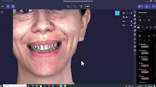 TRIOS intraoral scanner and RayFace 200 face scanner superimposing scans procedures [upl. by Gore]