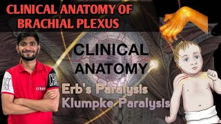 Erbs and Klumpke Paralysis Clinical anatomy on Brachial plexus [upl. by Lecrad]