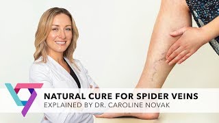 Medical Center Natural Cure for Varicose Veins  Top Vein Expert New York 10016 [upl. by Enirbas]