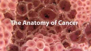 What Is Cancer What Causes Cancer amp How Is It Treated [upl. by Carlstrom]