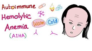 Autoimmune Hemolytic Anemia AIHA  Warm autoantibodies IgG  Hematology [upl. by Aronow669]