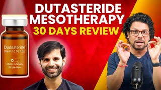 Dutasteride Mesotherapy 30 Days Review  Hair Loss  Hair Regrowth  Hair Tips  Adon Hair Care [upl. by Breh]