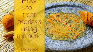 How To Use Turmeric To Treat Psoriasis  Ayurvedic Remedy  Bowl Of Herb [upl. by Ettesyl349]