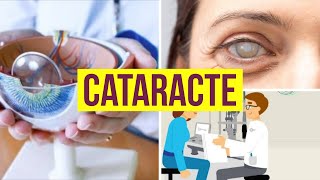 LA CATARACTE  DEFINITION  SYMPTOMES  ETIOLOGIES  TRAITEMENT [upl. by Schoof638]