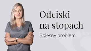 Odciski na stopach Bolesny problem [upl. by Seta]