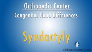 syndactyly  congenital hand differences  Boston Childrens Hospital [upl. by Anyad]