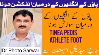 Tinea Pedis Or Athlete FooT Treatment  Dr Photo Sarwar Health Tips [upl. by Navinod]