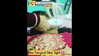 Revitalize Your Beauty HIFU Face Skin Tightening Treatment with Dr Deepesh Goyal [upl. by Naivatco784]