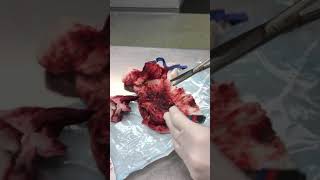 Watch what is found as this dogs intestine is opened [upl. by Gervase]