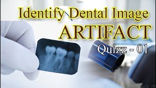 Identify Dental Xray Image Artifacts Quiz 01 [upl. by Bohs279]