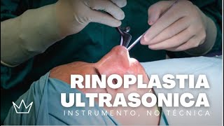 La RINOPLASTIA ULTRASÓNICA 👃 MENOS dolor resultados RÁPIDOS y mejor RECUPERACIÓN [upl. by Ebsen]