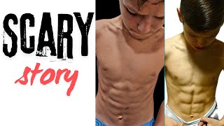 What Happened to My Abs  10 Pack or injury [upl. by Drhcir13]