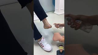 REACT  Silicone Foot Prosthesis Fit Silicone Foot Prosthesis Fit Luxmed ProstheticLimb [upl. by Hamel837]