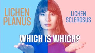 Lichen Sclerosus and lichen planus whats the difference [upl. by Legyn386]