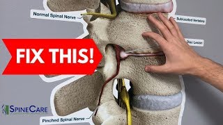 How to Fix a Bulging Disc in Your Lower Back  RELIEF IN SECONDS [upl. by Audie463]