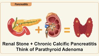 Renal Stone  Chronic Calcification Pancreatitis  Think of Parathyroid Adenoma [upl. by Hsot]